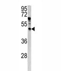 ANGPTL7 Antibody