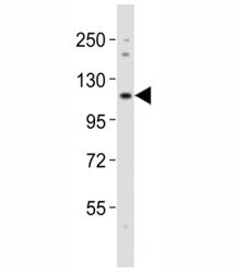 Western blot testing of Notch1 antibody at 1:2000 dilution + mouse lung lysate; Predicted molecular