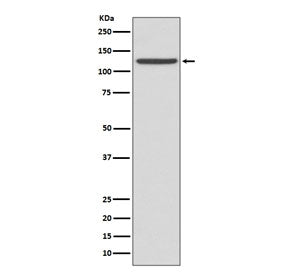 CD41 Antibody / ITGA2B