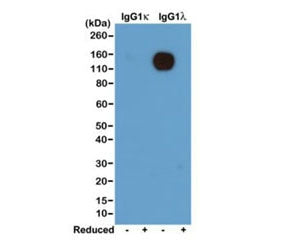 Lambda Light Chain Antibody / Lambda Antibody