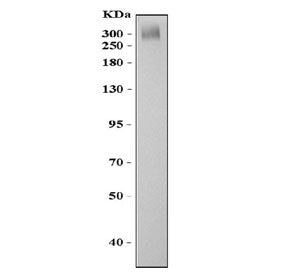 Western blot testing of ABCA4 antibody and mouse eye tissue lysate. Predicted molecular weight ~256