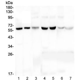 tPA Antibody / Tissue Plasminogen Activator