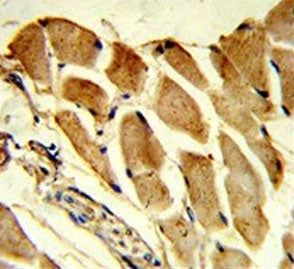 FHL1 Antibody / SLIM1