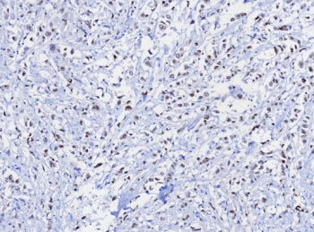 IHC staining of FFPE human uterus tissue with TRPS1 antibody; Strong nuclear staining observed with