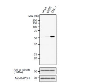 Western blot analysis of human HeLa, U2OS, and CHL-1 cell lysates using Detyrosinated Alpha-Tubulin