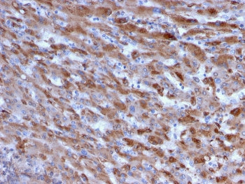C1QA Antibody / Complement C1q A-Chain