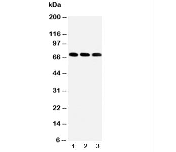 Western blot testing of IRAKM antibody and Lane 1: HeLa; 2: Jurkat; 3: HUT102 cell lysate. Predicted