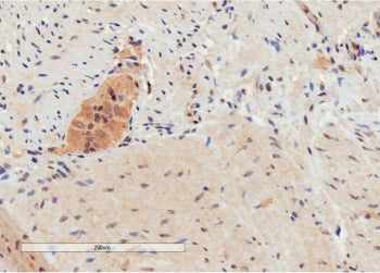 GPR120 Antibody