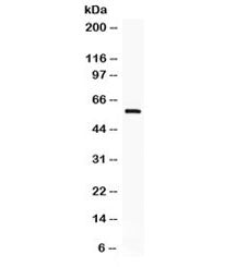 Western blot testing of human HeLa cell lysate with IKAROS antibody. Expected molecular weight: ~65/