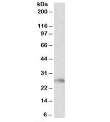HLA-DQA2 Antibody