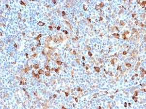 Fascin 1 Antibody