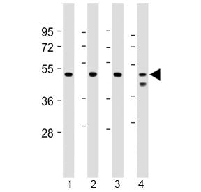 PSMC2 Antibody (Proteasome 19S S7)