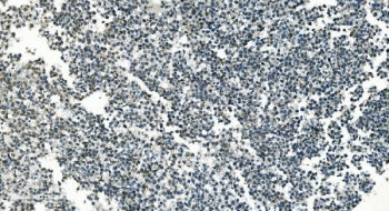 PI16 Antibody