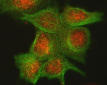 Cdk4 Antibody