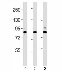 Western blot testing of Suz12 antibody at 1:2000 dilution. Lane 1: mouse spleen lysate; 2: mouse cer