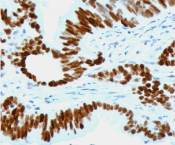 p53 Antibody / TP53