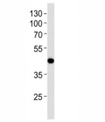Western blot analysis of lysate from NCI-H292 cell line using AIM2 antibody at 1:1000. Predicted mol
