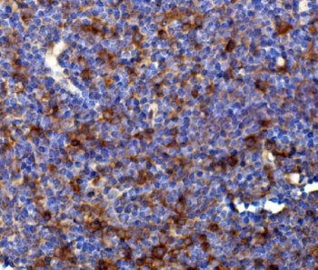 Rad17 Antibody