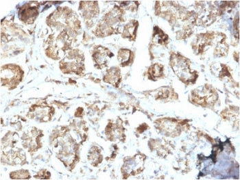 NME2 Antibody / NM23-H2
