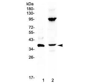 IL12 p40 / IL-12B Antibody