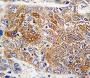 ALDH1L1 Antibody