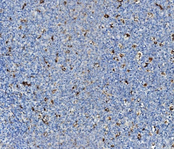Niemann Pick C2 Antibody / NPC2