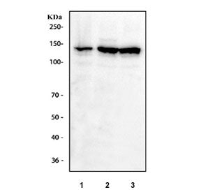 Western blot testing of human 1) A431, 2) K562 and 3) HEL cell lysate with IFNAR1 antibody at 0.5ug/