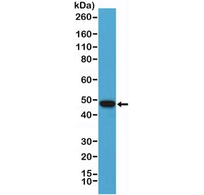 PAX-5 Antibody