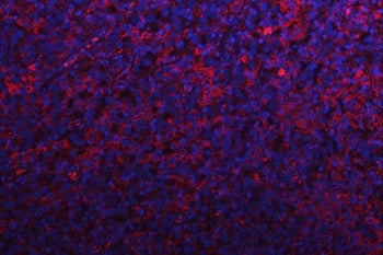Immunofluorescent staining of FFPE human testis cancer with RPS15A antibody (red) and DAPI nuclear s
