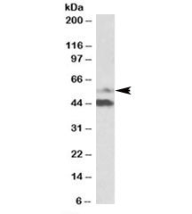 Western blot testing of human colorectal cancer lysate with PYROXD1 antibody at 1ug/ml. Predicted/ob