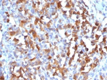 MART-1 / Melan-A Antibody