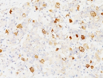 FSH beta Antibody