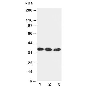 DKK1 Antibody
