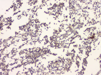 Amyloid beta Antibody / APP