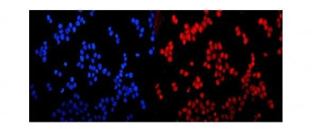 Immunofluorescent staining of FFPE human MCF7 cells with Glucocorticoid receptor antibody (red) and