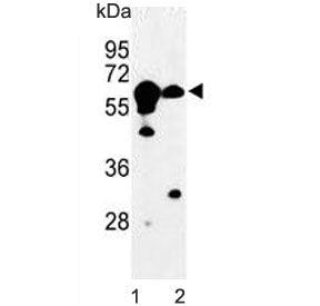 CBS Antibody / Cystathionine Beta Synthase