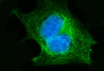 FGFR3 Antibody / Fibroblast Growth Factor Receptor 3