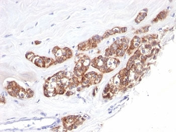 Cytokeratin 18 Antibody