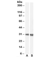 Dcdc2a Antibody