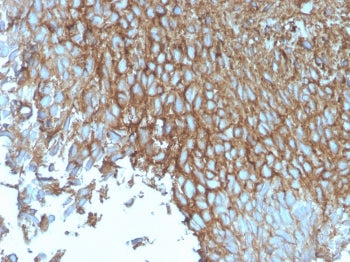 GLUT1 Antibody / SLC2A1