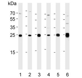 Adenylate kinase 4 Antibody / AK4