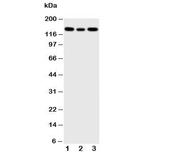 IGF1R Antibody