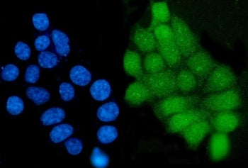 Grainyhead-like protein 1 Antibody / GRHL1