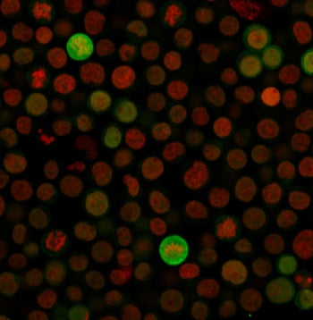 Immunofluorescent staining of fixed human Jurkat cells with anti-Bax antibody (clone SPM336, green)