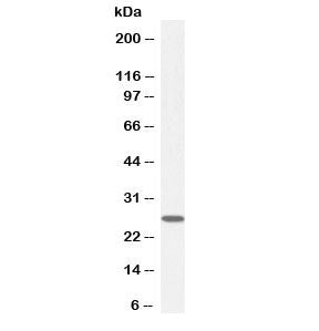 GSTM4 Antibody / Glutathione S-Transferase mu 4