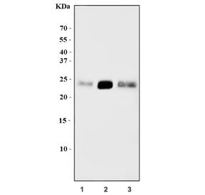 RHOB Antibody / ARHB