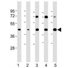 Glycogenin Antibody / GYG1 (C-Terminal Region)