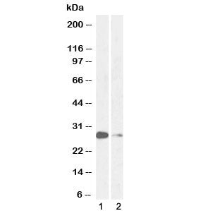 ASCL1 Antibody / MASH1