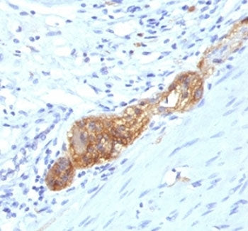 NCAM / CD56 Antibody