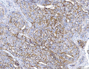 ENPP1 Antibody
